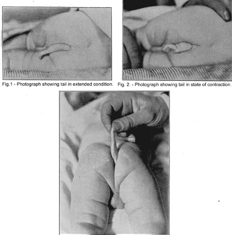 Naam: baby met staart.jpg
Bekeken: 410
Grootte: 39,4 KB