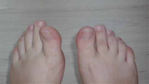 Klik op de afbeelding voor een grotere versie

Naam:  tenen.jpg
Bekeken: 217
Grootte:  568,5 KB
ID: 40033