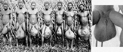 Naam: Black_scrotum2.jpg
Bekeken: 2291
Grootte: 44,4 KB