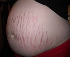 Naam: zwanger.jpg
Bekeken: 1192
Grootte: 10,8 KB